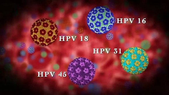 其中2万人需要进一步检查确保不会得子宫颈癌; -110人患上因hpv病毒