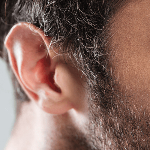 耳朵红肿也能说明健康问题？有什么方法可以改善？