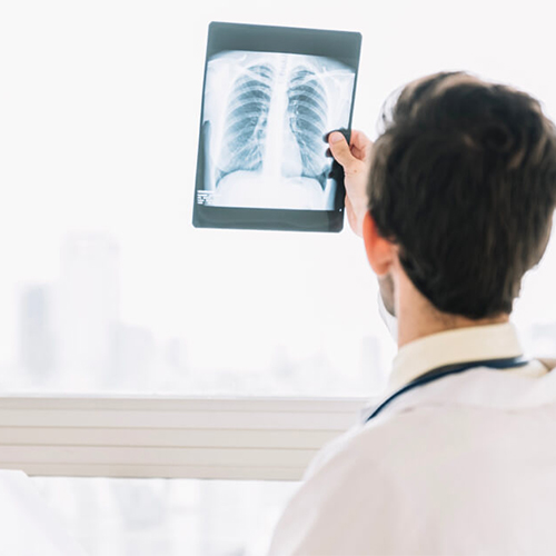 长期抽烟导致罹患肺癌，应该远离哪些因子？