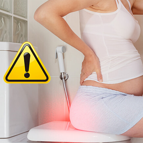 孕产妇为什么容易罹患痔疮？有什么方法可以预防？